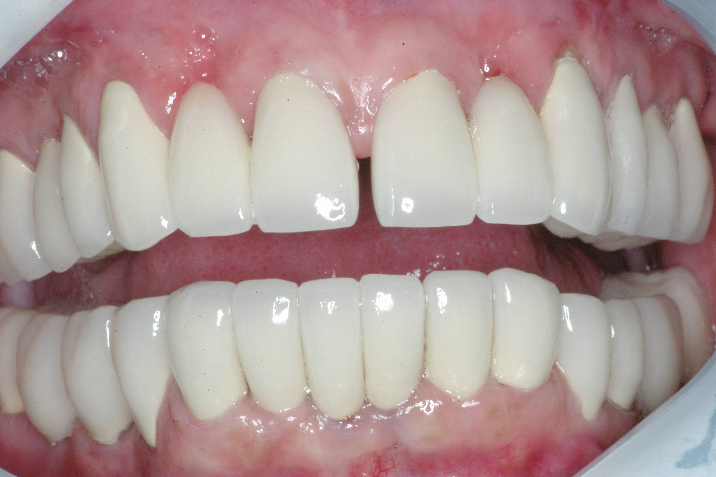 Eastlake Center for  Implants & Restorative Dentistry Eastlake Center for  Implants & Restorative Dentistry