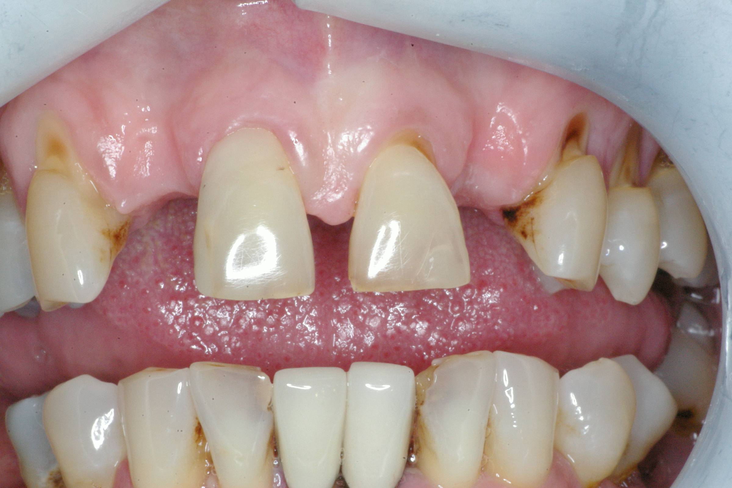 Eastlake Center for  Implants & Restorative Dentistry Eastlake Center for  Implants & Restorative Dentistry