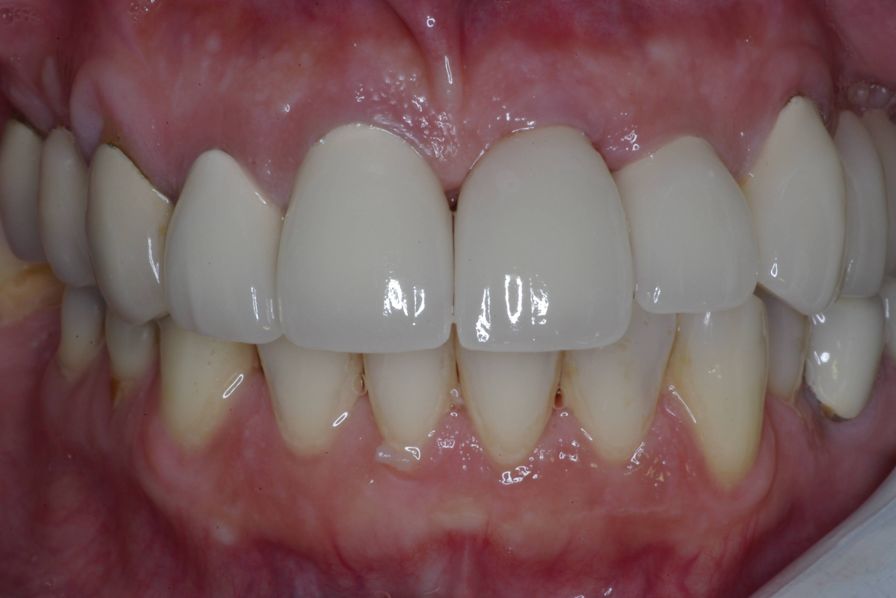 Eastlake Center for  Implants & Restorative Dentistry Eastlake Center for  Implants & Restorative Dentistry