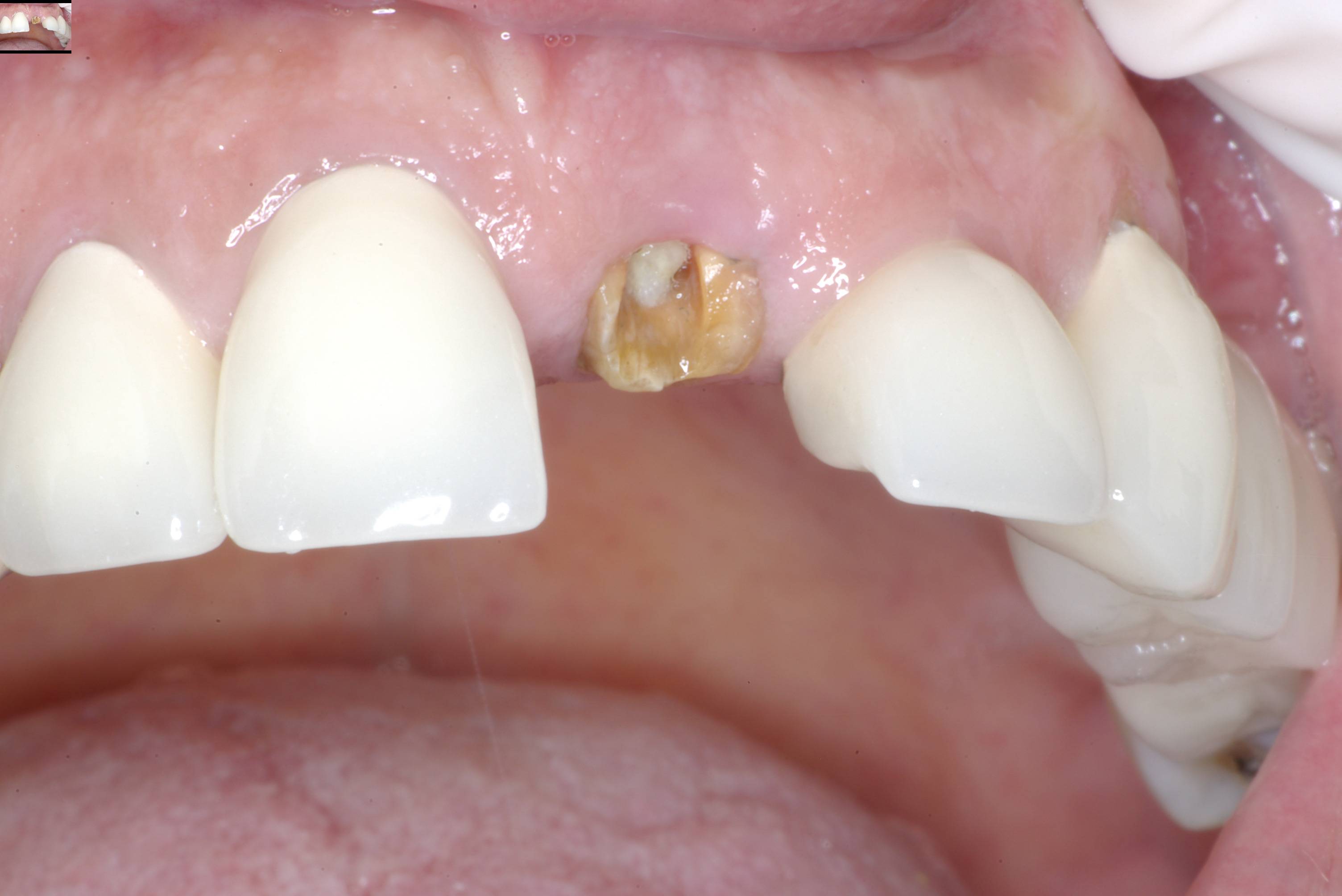 Eastlake Center for  Implants & Restorative Dentistry Eastlake Center for  Implants & Restorative Dentistry